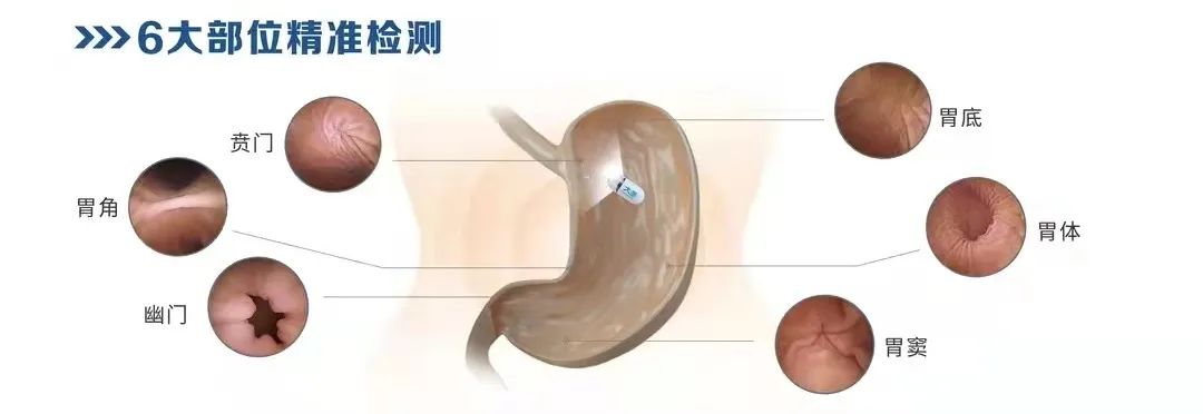 检查部位
